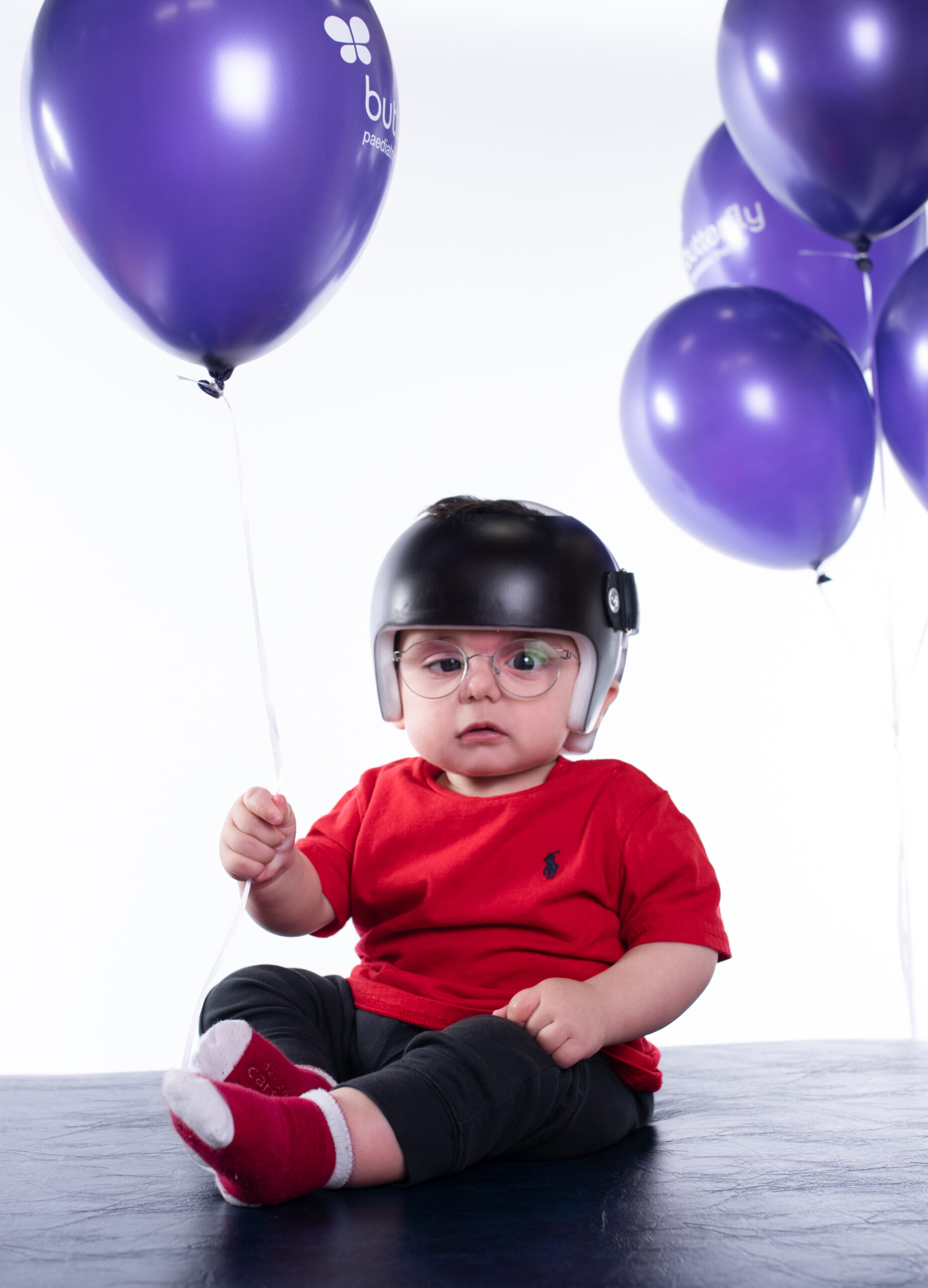 Plagiocephaly – Flat Heads in Infants